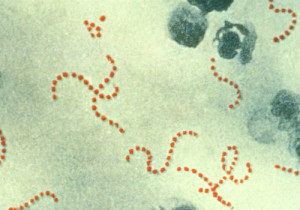 4-Streptococcus_pyogenes